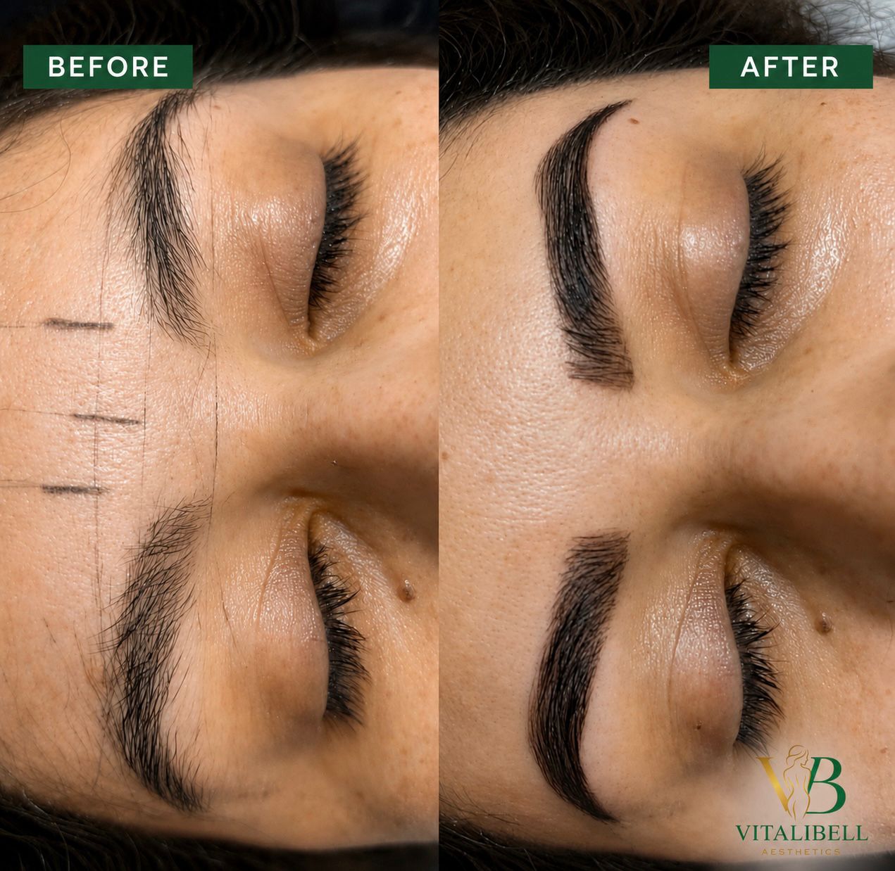Antes y después de microblading nano stroke en Kendall Miami